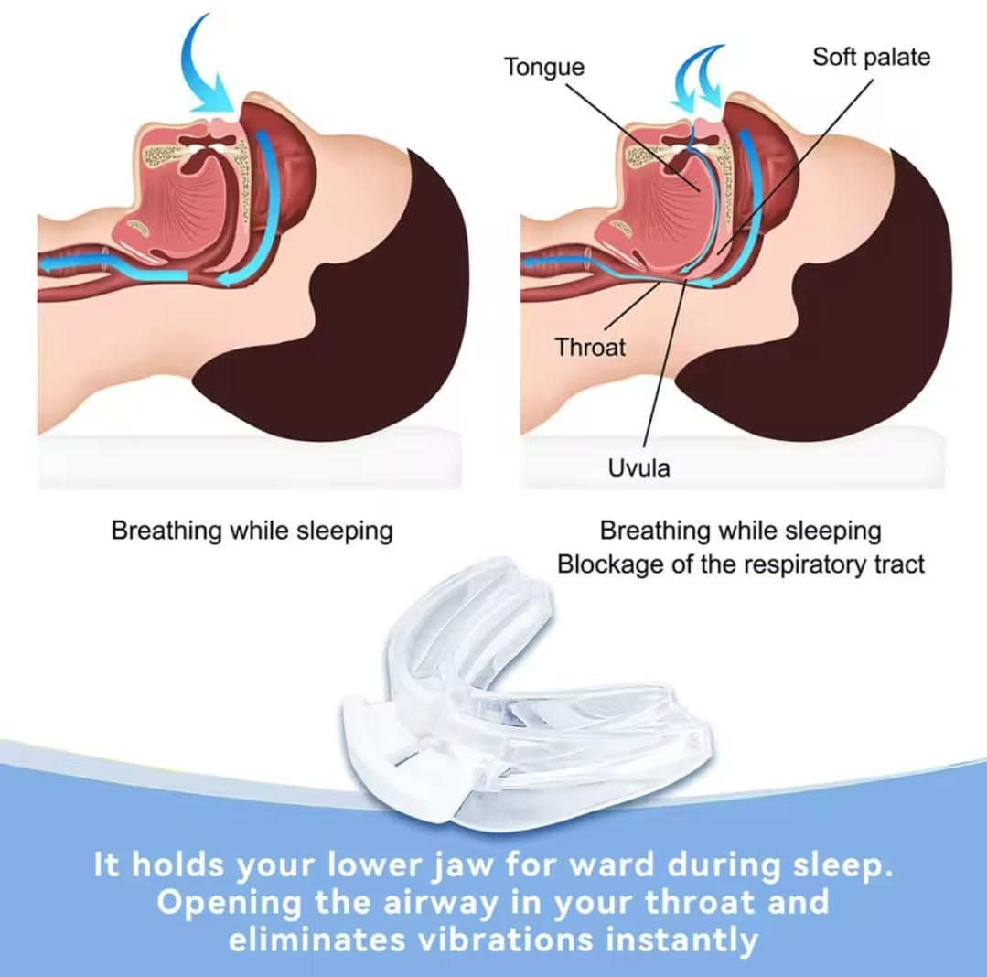 Anti Snore Mouth Braces