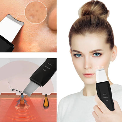 Ultrasonic Skin Shovel